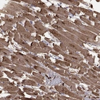 Immunohistochemical staining of human heart muscle shows strong cytoplasmic positivity in cardiomyocytes.