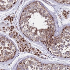 Immunohistochemical staining of human testis shows strong granular cytoplasmic positivity in cells in seminiferous ducts and leydig cells.