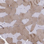 Immunohistochemical staining of human skeletal muscle shows moderate cytoplasmic positivity in a subset of myocytes.