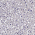 Immunohistochemical staining of human liver shows no positivity in hepatocytes as expected.