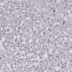 Immunohistochemical staining of human liver shows no positivity in hepatocytes as expected.