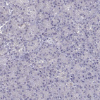 Immunohistochemical staining of human pancreas shows no positivity in exocrine glandular cells as expected.