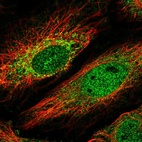 Anti-HKR1 Antibody