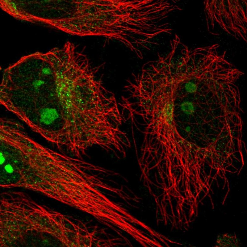 Anti-NCKAP5 Antibody