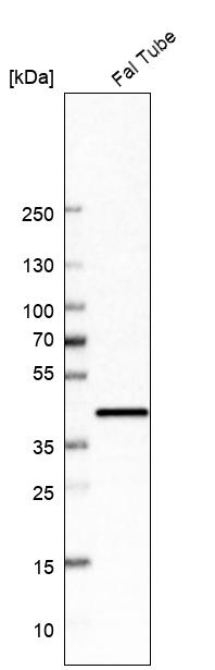 Anti-UBIAD1 Antibody