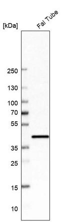 Anti-UBIAD1 Antibody