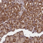 Anti-TSPYL4 Antibody