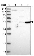 Lane 1: Marker [kDa] 250, 130, 95, 72, 55, 36, 28, 17, 10_br/_Lane 2: Human cell line RT-4_br/_Lane 3: Human cell line U-251MG sp_br/_Lane 4: Human plasma (IgG/HSA depleted)