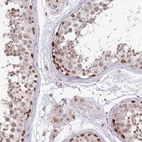 Immunohistochemical staining of human testis shows high expression.