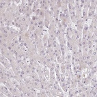 Anti-BARD1 Antibody