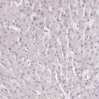 Immunohistochemical staining of human liver shows low expression as expected.