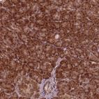 Anti-NUDT9 Antibody