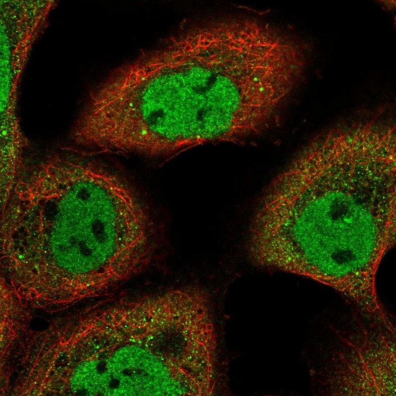 Anti-ARMC8 Antibody