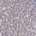 Immunohistochemical staining of human liver shows strong cytoplasmic granular positivity in hepatocytes.