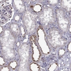 Immunohistochemical staining of human kidney shows strong cytoplasmic granular positivity in cells in tubules.