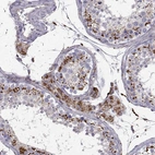 Immunohistochemical staining of human testis shows strong cytoplasmic granular positivity in Leydig cells.
