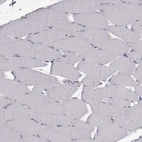 Immunohistochemical staining of human skeletal muscle shows no positivity in myocytes as expected.