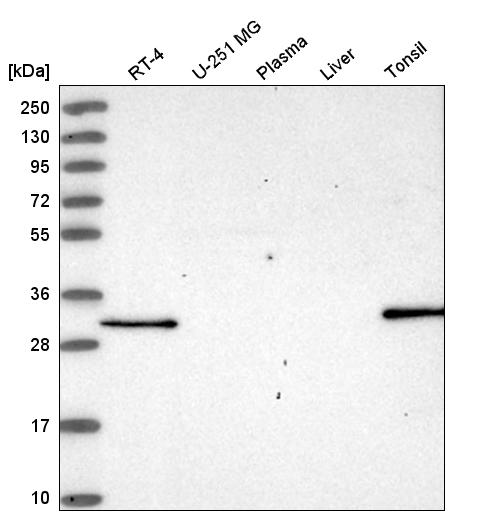 Anti-NSMCE4A Antibody
