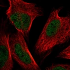 Immunofluorescent staining of human cell line U-2 OS shows localization to nucleoplasm.