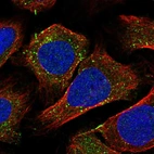 Immunofluorescent staining of human cell line U-2 OS shows localization to vesicles.