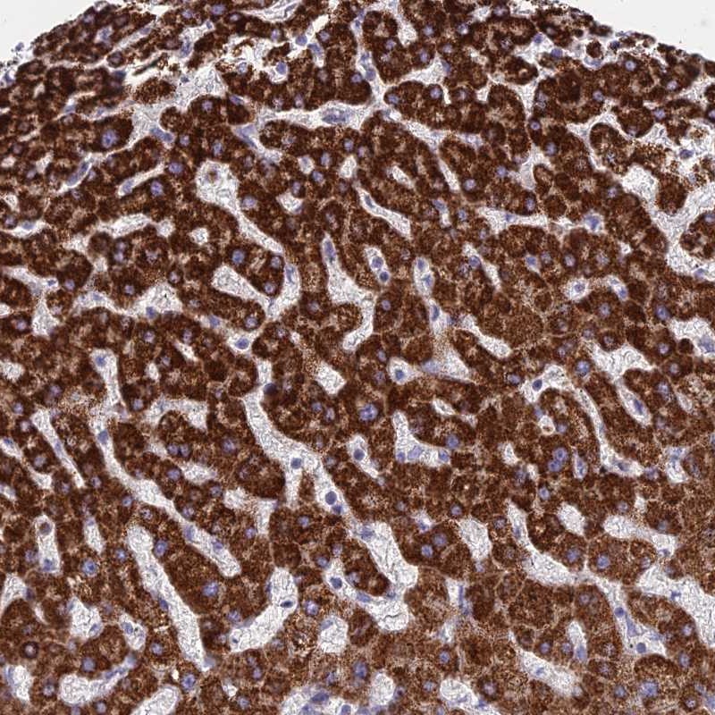 Anti-C11orf74 Antibody