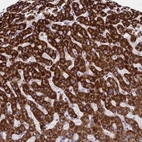 Anti-C11orf74 Antibody