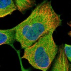 Immunofluorescent staining of human cell line HEK 293 shows localization to cytosol & aggresome.