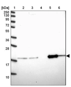 Lane 1: Marker [kDa] 250, 130, 95, 72, 55, 36, 28, 17, 10_br/_Lane 2: Human cell line RT-4_br/_Lane 3: Human cell line U-251MG sp_br/_Lane 4: Human plasma (IgG/HSA depleted)_br/_Lane 5: Human liver tissue_br/_Lane 6: Human tonsil tissue