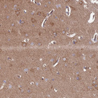 Anti-INSM2 Antibody