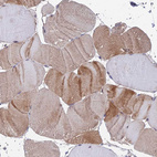 Immunohistochemical staining of human skeletal muscle shows weak cytoplasmic positivity in myocytes.