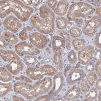 Immunohistochemical staining of human kidney shows weak cytoplasmic positivity in cells in tubules.