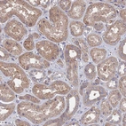 Immunohistochemical staining of human kidney shows weak cytoplasmic positivity in cells in tubules.