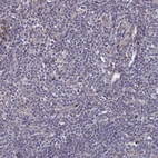 Immunohistochemical staining of human tonsil shows very weak positivity in non-germinal center cells.