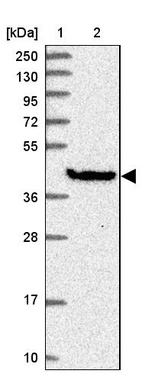 Lane 1: Marker [kDa] 250, 130, 95, 72, 55, 36, 28, 17, 10_br/_Lane 2: Human cell line RT-4