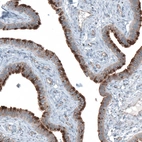 Immunohistochemical staining of human Fallopian tube shows strong positivity in apical membrane in glandular cells.