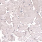 Immunohistochemical staining of human skeletal muscle shows no positivity in striated muscle fibers as expected.