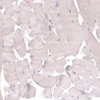 Immunohistochemical staining of human skeletal muscle shows no positivity in striated muscle fibers as expected.