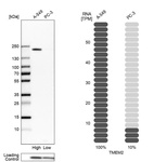Western blot analysis in human cell lines A-549 and PC-3 using Anti-TMEM2 antibody. Corresponding TMEM2 RNA-seq data are presented for the same cell lines. Loading control: Anti-PPIB.
