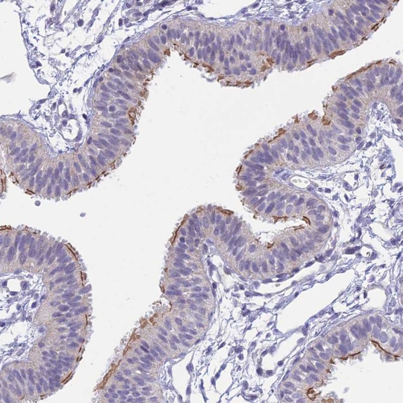 Anti-CFAP206 Antibody
