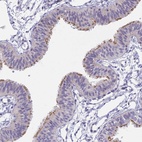 Anti-CFAP206 Antibody