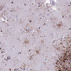 Anti-IFT172 Antibody