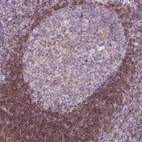 Anti-LY86 Antibody