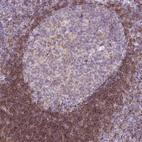 Anti-LY86 Antibody