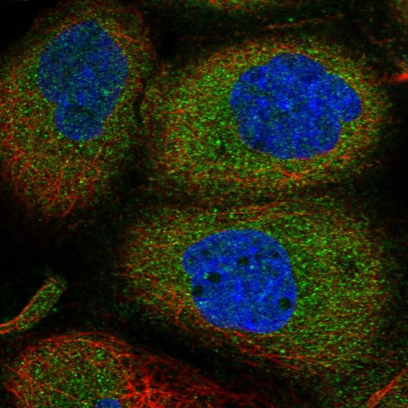 Anti-ANKMY2 Antibody
