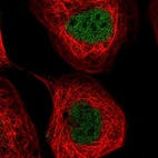 Immunofluorescent staining of human cell line A-431 shows localization to nucleoplasm.