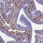 Immunohistochemical staining of human fallopian tube shows strong membranous positivity in cells in lamina propria.