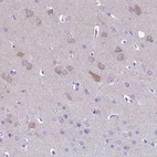 Immunohistochemical staining of human cerebral cortex shows weak to moderate cytoplasmic positivity in neuronal cells.