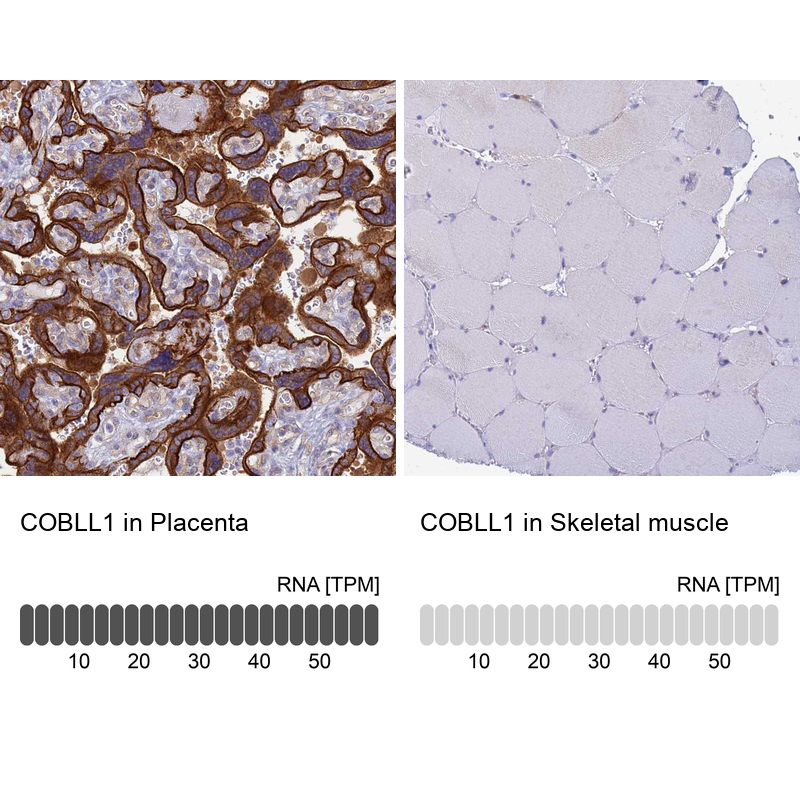 Anti-COBLL1 Antibody
