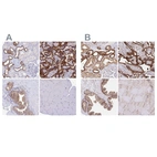 Immunohistochemical staining of human kidney, placenta, prostate and skeletal muscle using Anti-COBLL1 antibody HPA044933 (A) shows similar protein distribution across tissues to independent antibody HPA053344 (B).