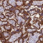 Immunohistochemical staining of human placenta shows strong membranous positivity in trophoblastic cells.